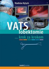 VATS LOBEKTOMIE krok za krokem