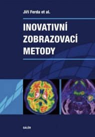 INOVATIVN&Iacute; ZOBRAZOVAC&Iacute; METODY