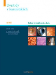 UVEITIDY V KAZUISTIK&Aacute;CH