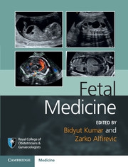 FETAL MEDICINE