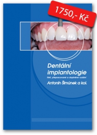 Dent&aacute;ln&iacute; implantologie, 3. vyd&aacute;n&iacute;, přepracovan&eacute; a doplněn&eacute;