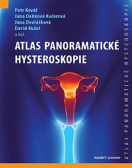 Atlas panoramatick&eacute; hyteroskopie