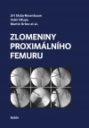 Zlomeniny proxim&aacute;ln&iacute;ho femuru
