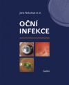 OČN&Iacute; INFEKCE