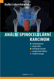 An&aacute;ln&iacute; spinocelul&aacute;rn&iacute; karcinom