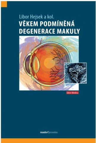 Věkem podm&iacute;něn&aacute; degenerace makuly