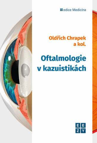 Oftalmologie v kazuistik&aacute;ch