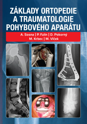 Z&aacute;klady ortopedie a traumatologie pohybov&eacute;ho apar&aacute;tu
