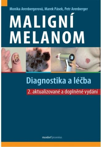 Malign&iacute; melanom - Diagnostika a l&eacute;čba, 2. vyd&aacute;n&iacute;