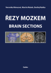 Řezy mozkem