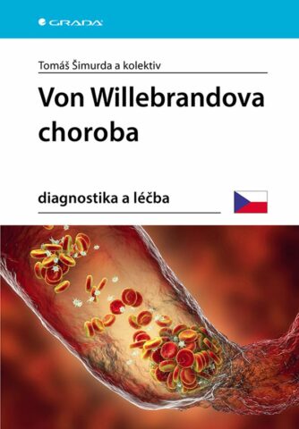 Von Willebrandova choroba, Diagnostika a l&eacute;čba